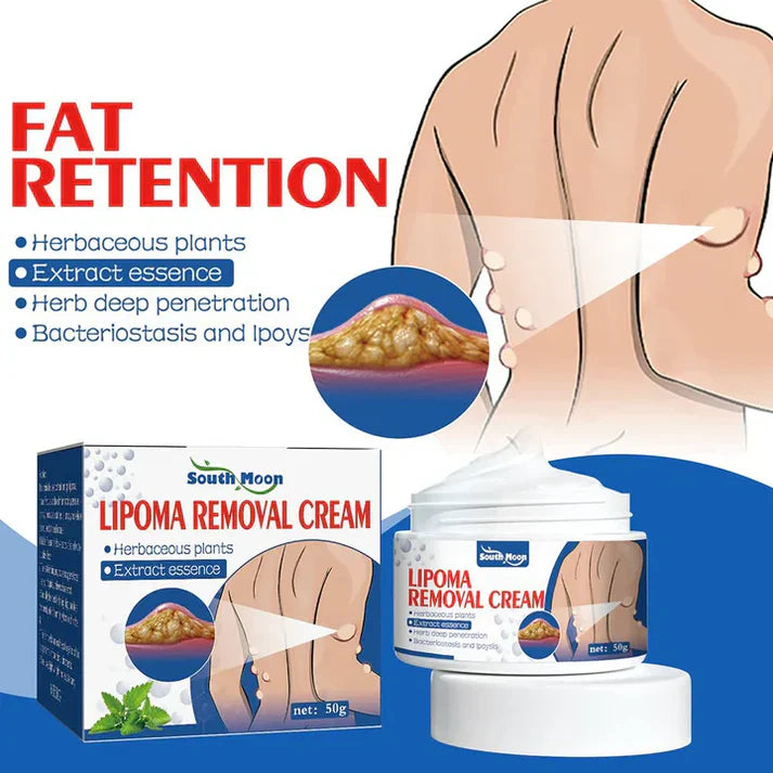 Sway - Lipoma Removal Cream (Buy 1 Get 2 Free)